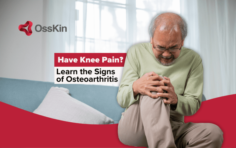 Signs And Symptoms Of Osteoarthritis | OssKin